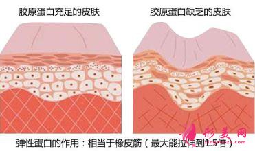 專家科普：怎么去除痘疤？價格是多少？