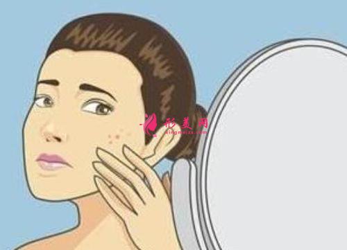 專家科普：怎么去除痘疤？價格是多少？