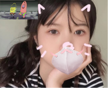 北京克萊美舍整形醫(yī)院張冰潔做的全切雙眼皮半年的變化。