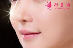 上海整形醫(yī)院做完假體隆鼻后效果自然嗎？