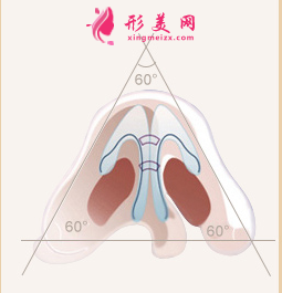 鼻頭整形多久可以消腫