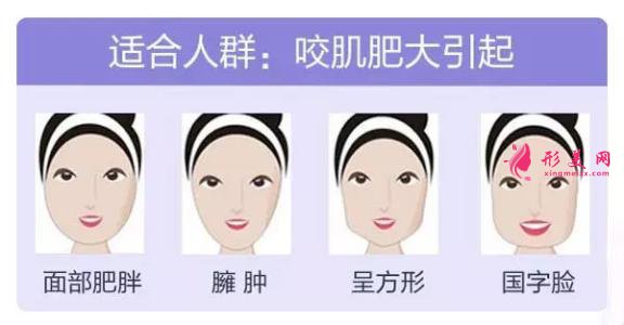 打瘦臉針效果怎么樣