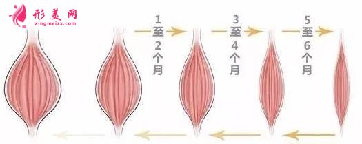 瘦臉針有效果嗎