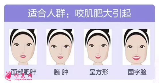 瘦臉針有效果嗎