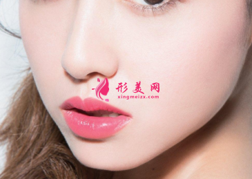 自體脂肪填充臉部恢復(fù)時間長嗎