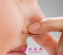鼻翼縮小整形術(shù)多久恢復自然