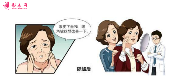 注射除皺效果怎么樣？附術(shù)前術(shù)后注意事項(xiàng)！