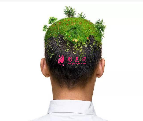 頭發(fā)種植效果可靠嗎？術(shù)前注意事項(xiàng)大全！