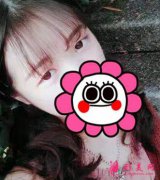 重慶附一院整形科張恒術雙眼皮案例分享：效果不讓你們失望！