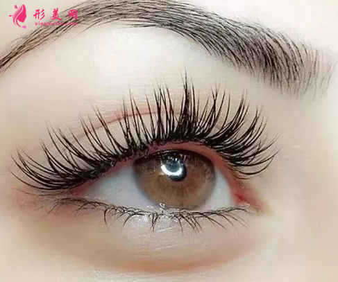 開(kāi)內(nèi)眼角的方法有哪些