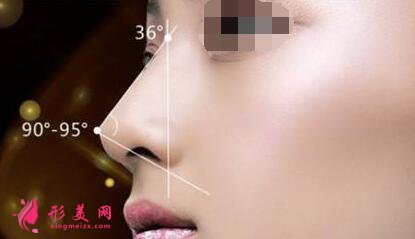 假體隆鼻后什么時(shí)候可以化妝