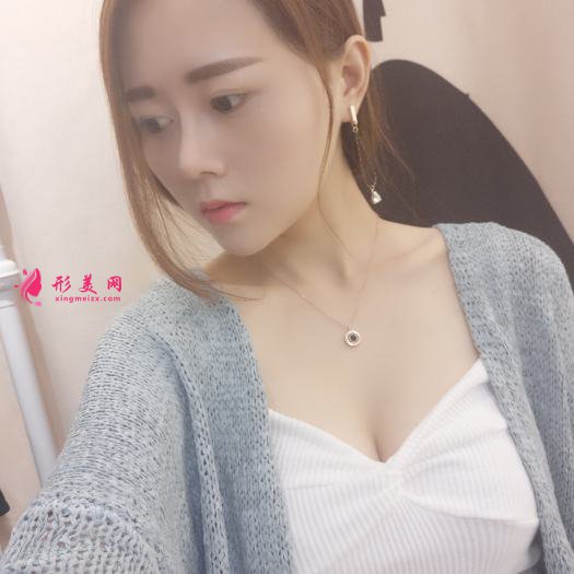 做自體肋軟骨和膨體綜合隆鼻后感受