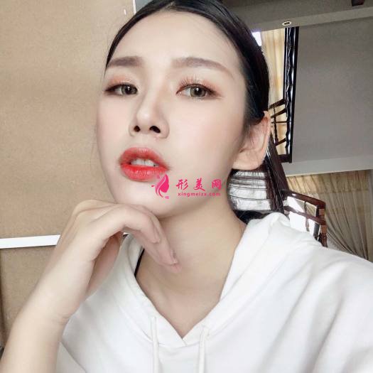 做完超皮秒祛斑效果是超級好