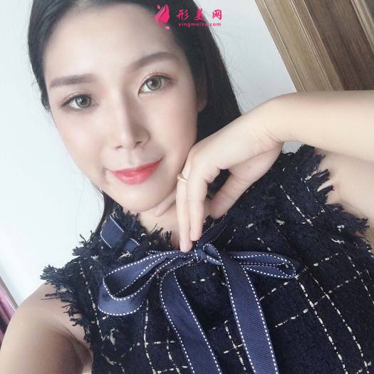 做完超皮秒祛斑效果是超級好