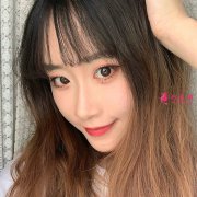 鄭州全切雙眼皮恢復(fù)的速度很快，就算是素顏也很美！