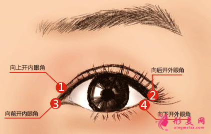 做開眼角后要多久恢復(fù)自然