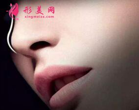自體軟骨隆鼻的費(fèi)用是多少