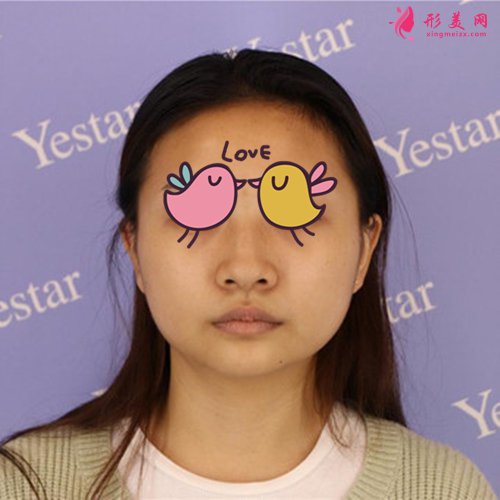 溫州藝星做鼻子怎么樣