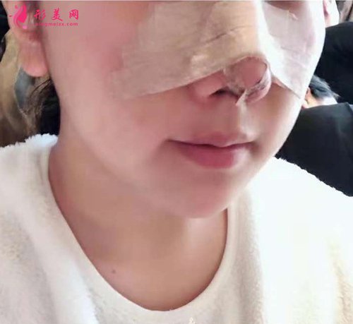 寧波哪個醫(yī)生做鼻子厲害