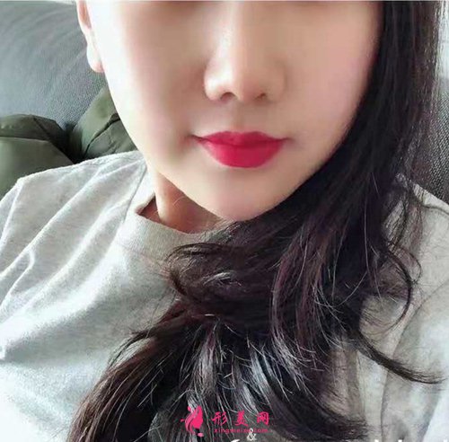 寧波壹加壹整形做鼻子好嗎