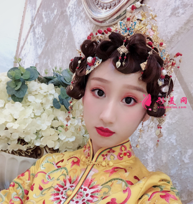 成都華美整形醫(yī)院隆鼻案例分享 40天前后對比圖