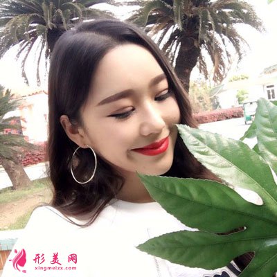 北京八大處楊明勇做雙眼皮修復(fù)手術(shù)后