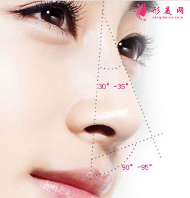 假體隆鼻后會(huì)有排異癥狀嗎