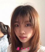 重慶西南醫(yī)院整形科隆鼻案例展示：術(shù)后獲得立體五官！