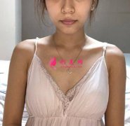 廣州南方醫(yī)院隆胸怎么樣？術(shù)后效果反饋！