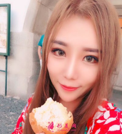 天津圣韓美醫(yī)療美容鼻部多項案例