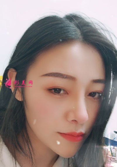 昆明藝星醫(yī)療美容醫(yī)院鼻部多項案例