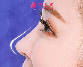 膨體隆鼻會有什么危害嗎
