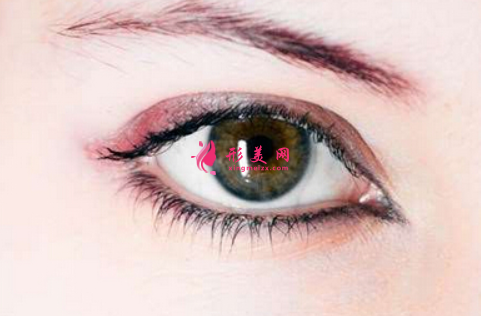開眼角手術出現(xiàn)了疤痕怎么辦