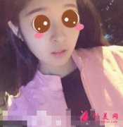 山東省立醫(yī)院整形科隆鼻怎么樣？術(shù)后案例前后對比圖