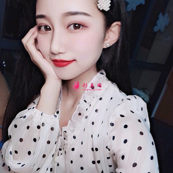 長沙美容院自體脂肪面部填充和假體豐下巴整形日記