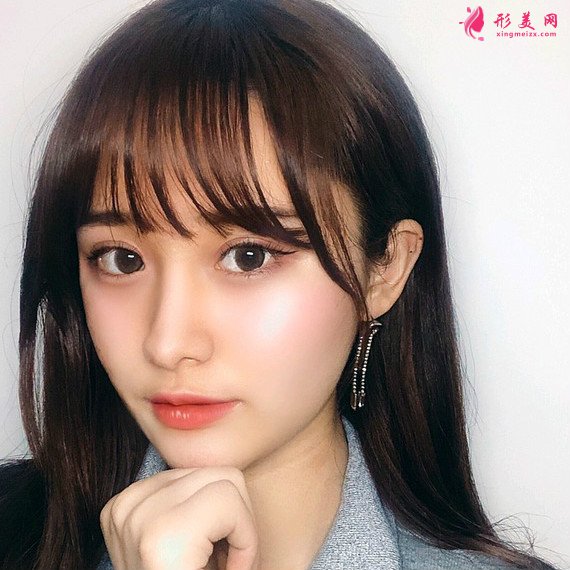 重慶美禪整形醫(yī)院做的全切雙眼皮效果還不錯