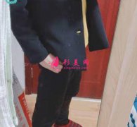 廣州曙光醫(yī)院抽脂怎么樣？90天了，來聊聊我的恢復經驗