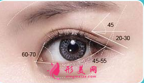 做完開眼角手術(shù)后要注意的護理事項