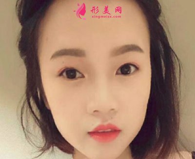 北京歐華醫(yī)療美容水光補水案例