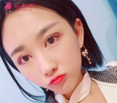 廈門華美醫(yī)療美容門診部眼部多項(xiàng)案例