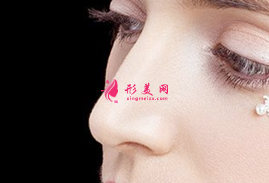 假體隆鼻失敗了需要取出嗎