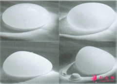 假體隆胸術(shù)后會影響哺乳嗎？