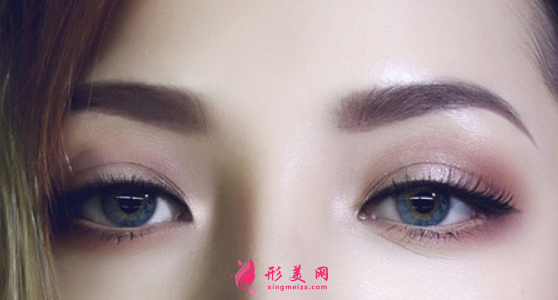 雙眼皮手術(shù)的疤痕明顯嗎