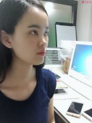 廣東韓妃整形楊德發(fā)做鼻綜合，術(shù)后效果真心不錯(cuò)