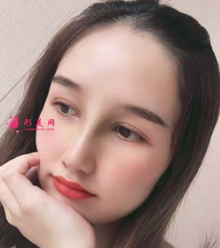 武漢韓辰醫(yī)療美容鼻部多項(xiàng)案例 