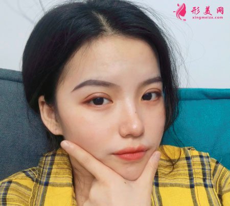 重慶美圣美邦醫(yī)療美容眼部多項案例