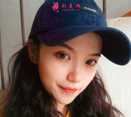 重慶美圣美邦醫(yī)療美容眼部多項案例