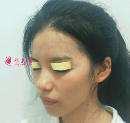 重慶美圣美邦醫(yī)療美容眼部多項案例