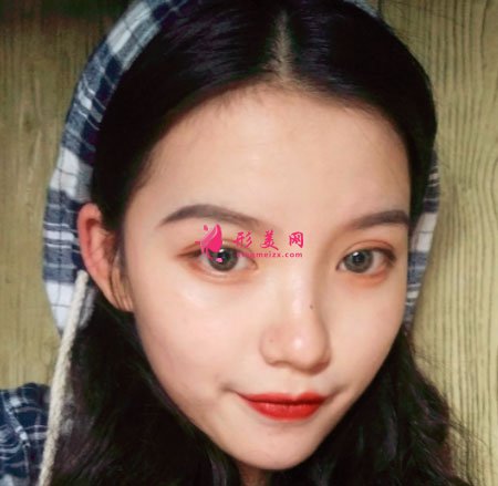 重慶美圣美邦醫(yī)療美容眼部多項案例
