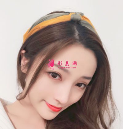 寧波珈禾肋軟骨隆鼻案例